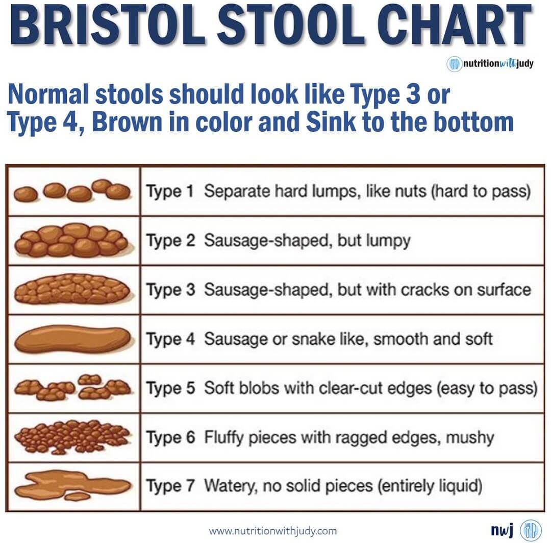 Microblog: The Bristol Stool Chart - Normal Stools Should Look Like ...